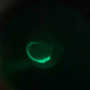 Zebrafish Embryo GFP