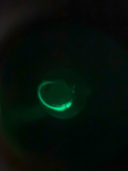 Zebrafish Embryo GFP